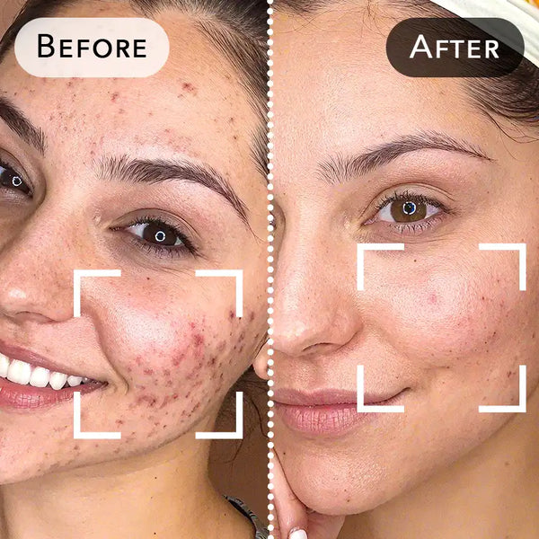 Before and after treatment