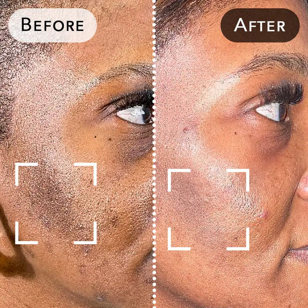 Before and after treatment