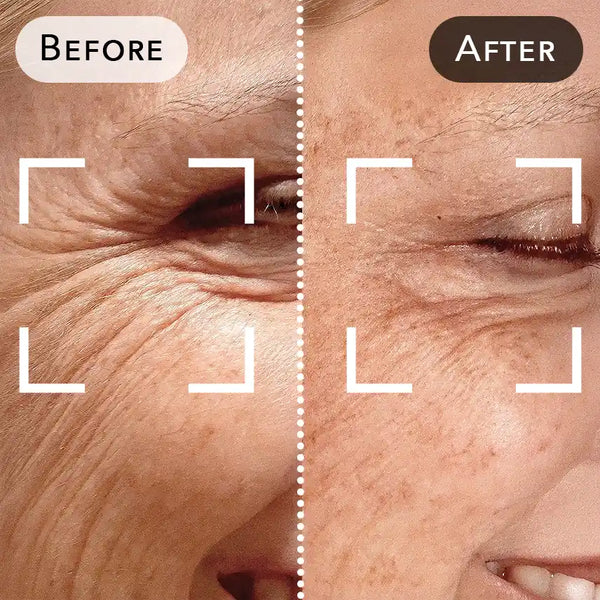 Before and after treatment